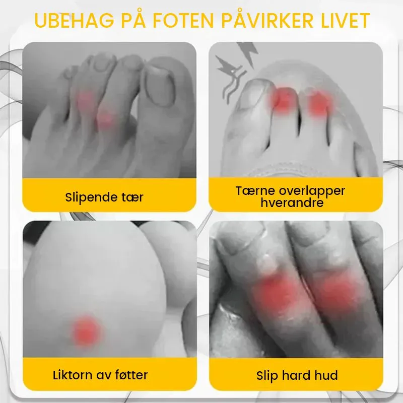 Silicone toe protector for less friction and pain